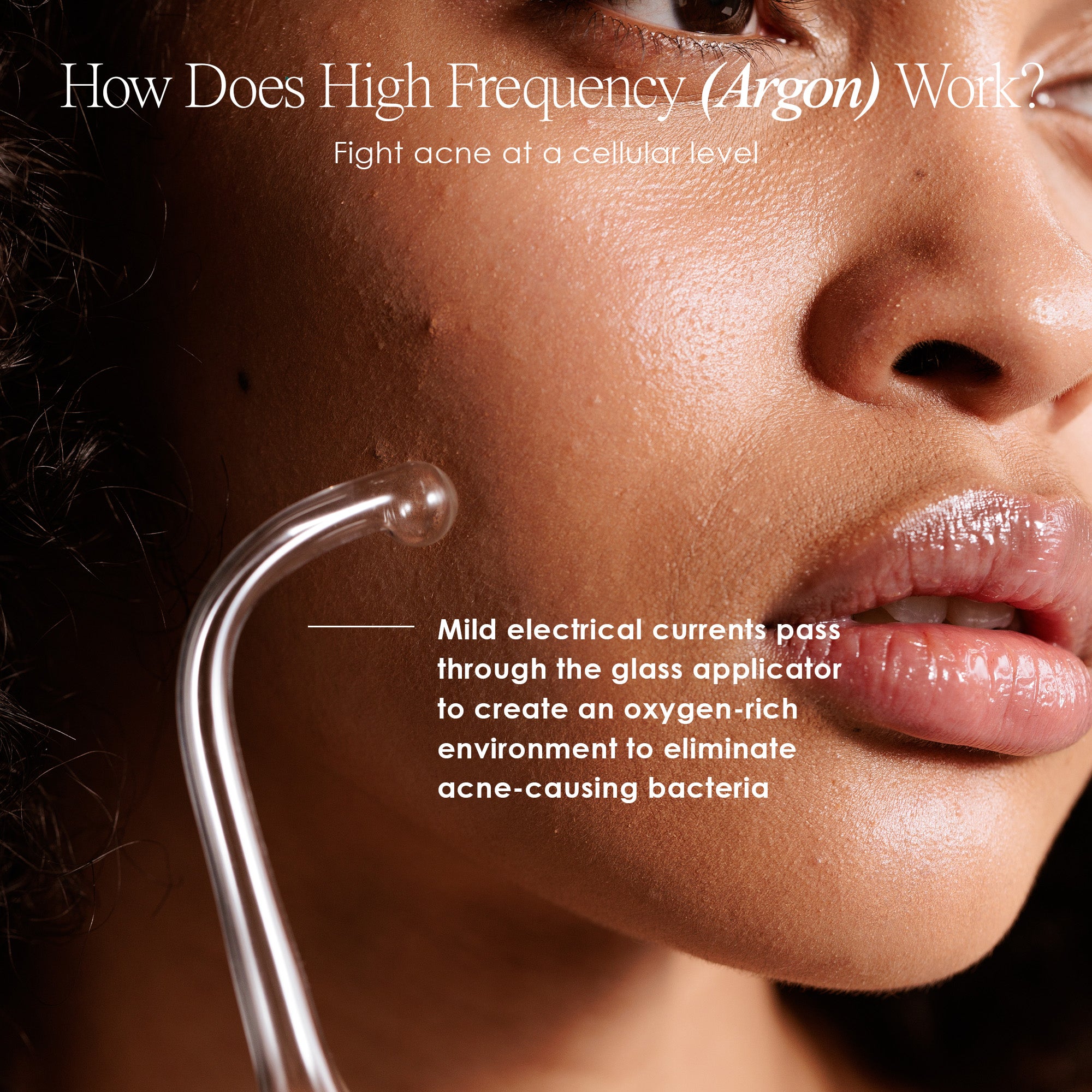 Faisca argon high frequency wand how high frequency treatment zaps acne